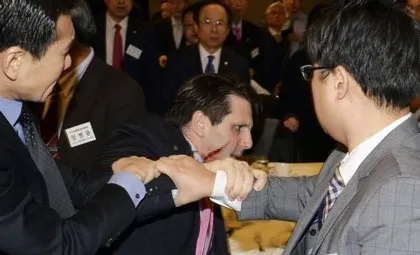 ABD’nin Seul Büyükelçisi’ne saldırı