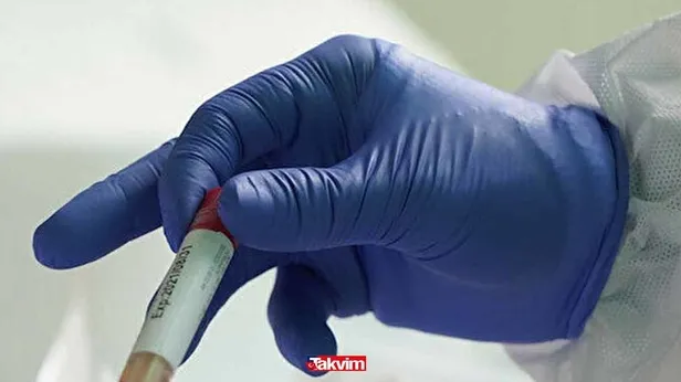 Gözler oradaydı! PCR testi sonucu nasıl öğrenilir, test sonucu ne zaman çıkar? PCR testi nerede yapılır? PCR testini kimler yaptıracak?-5