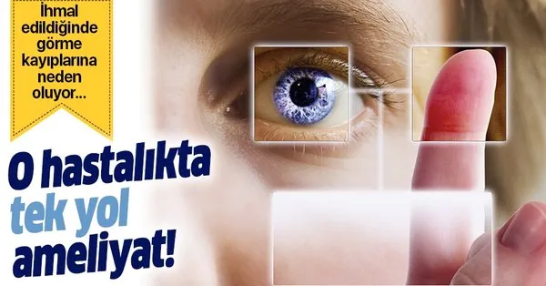 katarakt 40 yasini bekler katarakt