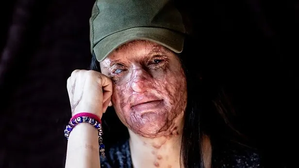 Berfin'in yüzüne asit türü sıvı atan sanık hakim karşısında-8