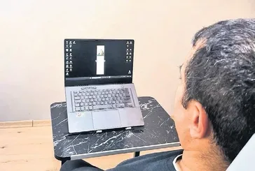 Kas hastaları için yapay zeka destekli çözüm