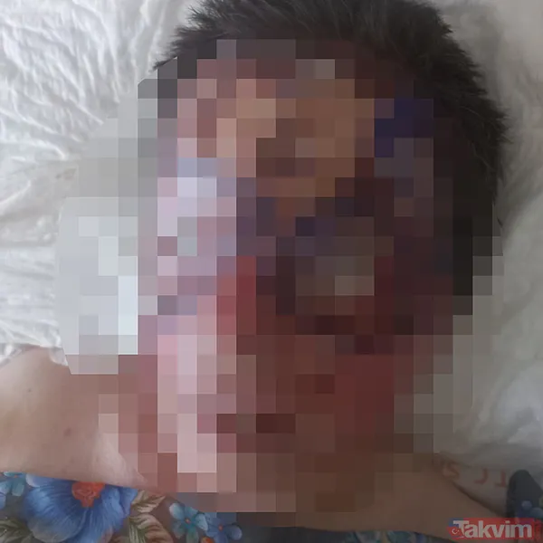 Yolda yürüyen kadının yüzüne kezzap döktü! Avcılar'da korkunç olay - 6