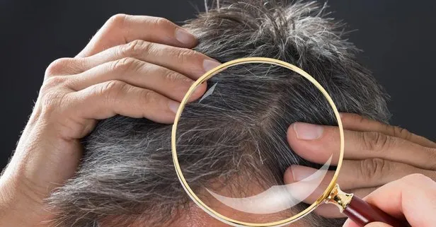 saclarina ak degil eksi dussun