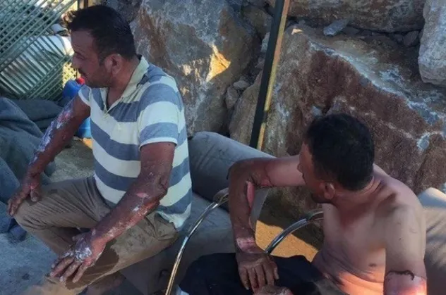 CHP'li Datça Belediyesi'nden skandal sorumsuzluk örneği! Engelli personeli alevlerin ortasına attılar