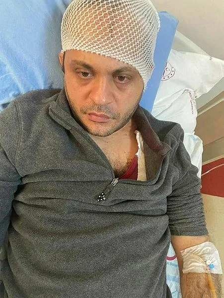 Kafasına mermerle öldüresiye vurulan doktora 8 dikiş atıldı! Yer: Gaziantep-1