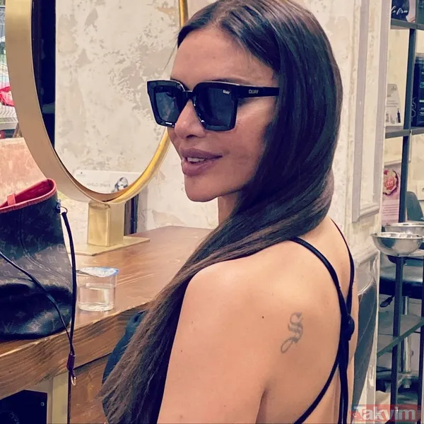 Köpek saldırısına uğrayan Tuğba Altıntop 'durum bu' deyip son halini yayınladı! Rafet El Roman’ın eski eşi hayranlarını korkutmuştu... - 17