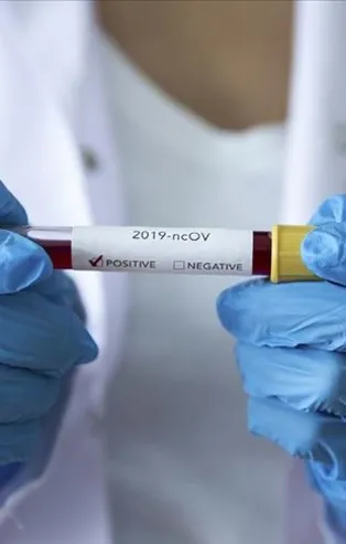 Son dakika: DSÖ'ye koronavirüs soruşturması