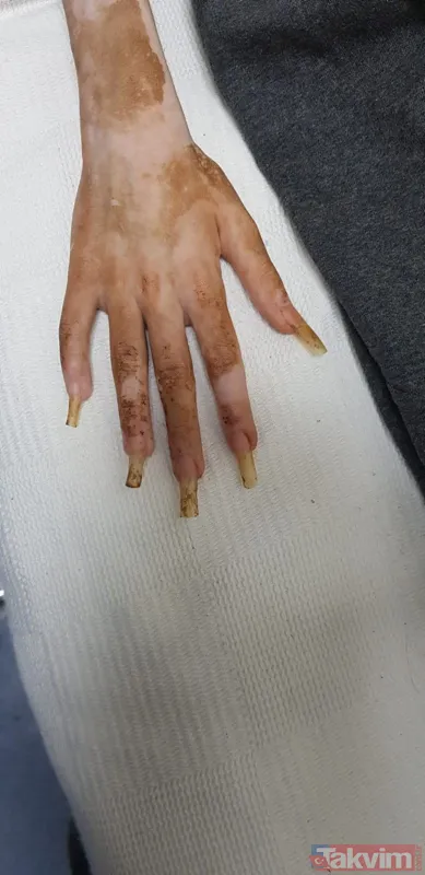 Bursa'da çöp ev içinde 1 yıldır yeğenini alıkoyan teyze Kamuran Pınar A. sorguda! Şoke eden ifadeler... Çocuklar korumaya alındı - 19