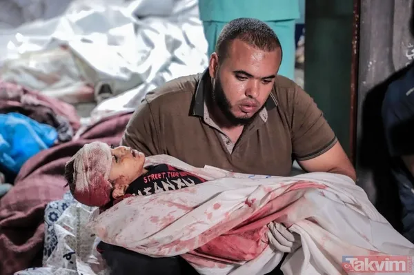 Dikkat!+18 | ABD'den soykırıma kalkan el! İşte işgalci İsrail'in Gazze'de uyguladığı katliamdan vahşet kareleri - 50