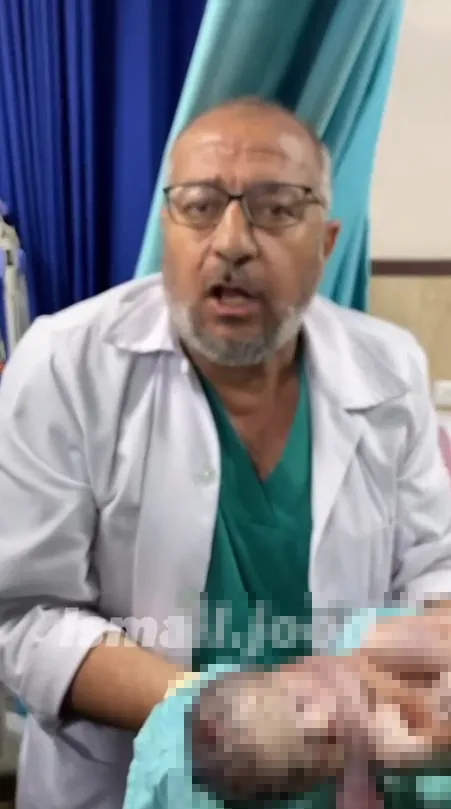 katliamin-golgesinde-yasamla-mucadele-anne-karninda-siyonist-teror-magduru-1698772952138.jpg Katliamın gölgesinde yaşamla mücadele! Anne karnında siyonist terör mağduru | Doktorlar annesi şehit edilen bebeği kurtarmak için ter döktü-6