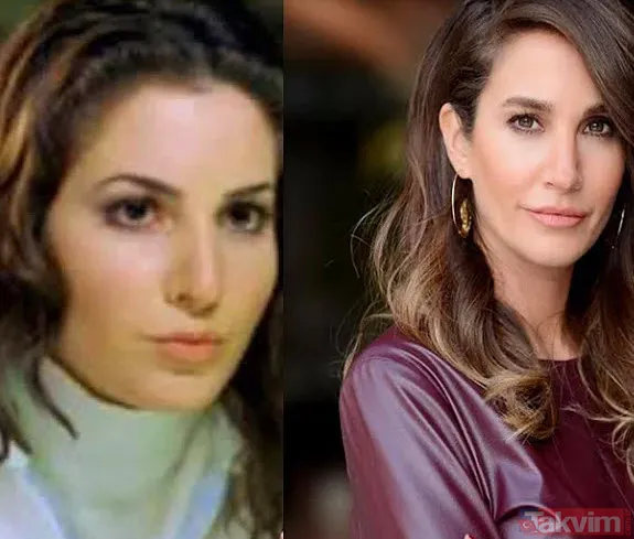 Şarkıcı Lara sonunda küçülttü! Estetikle bambaşka biri olan Lara paylaştı görenler 'yok artık' dedi - 36