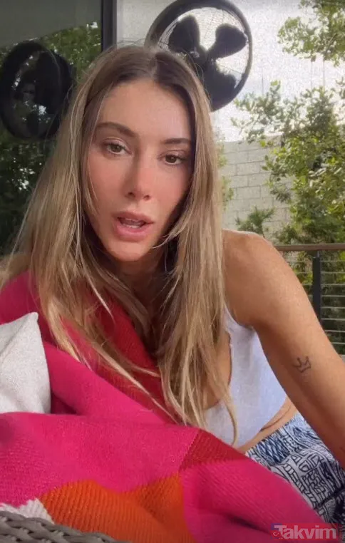 Acun Ilıcalı'nın yüzü gözü morluk içinde gören darp edildi sanıyor ama işin aslı başka! Estetik mi derken... - 23