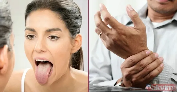 Bu belirtiler sizde de varsa dikkat! Yüzünüz hangi vitamin eksikliğiniz olduğunu söylüyor! - 8