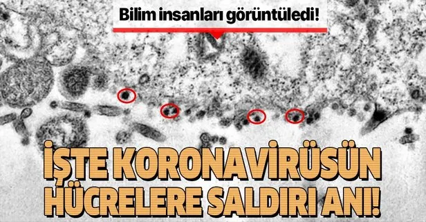 İşte koronavirüsün insan hücrelerine saldırdığı o an!