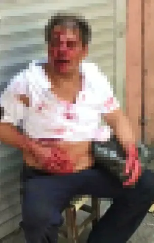 Taciz iddiası Kasımpaşa'yı karıştırdı! Darp edip bıçakladılar