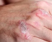 Sedef artık yok olacak