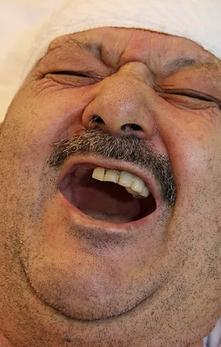 Diş ağrısı sandı sağlam 6 dişini çektirdi! Gerçek bambaşka çıktı! Delirten hastalık...