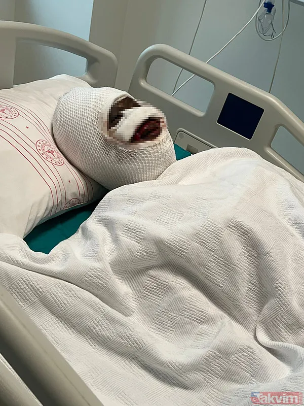 Gaziantep'te dehşet: Adem Külah eski eşini koli bandı ile bağlayıp başından aşağı kezzap döktü! - 4