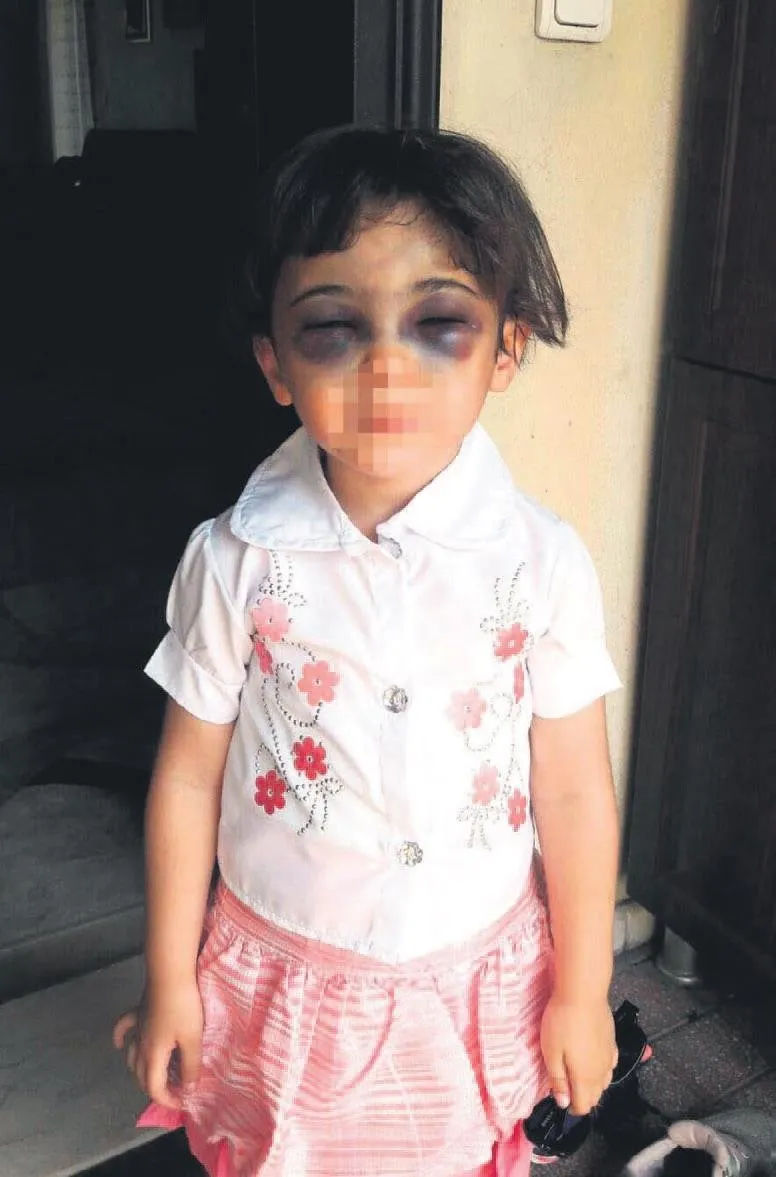 Ellerin kırılsın
