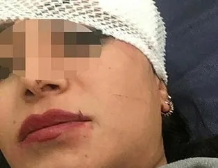 Jiletle yüzünü parçaladı! Konya’da gazinoda sevgilisiyle gördüğü kız arkadaşına saldırdı