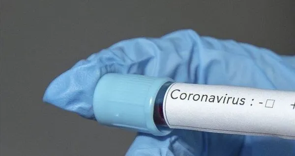 Fransa'da koronavirüs kontrolden çıktı! Son 24 saatte 14 bin Kovid-19 vakası-5