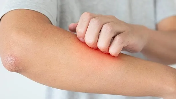 dr-nafiz-karagozoglu-degerlendirdi-birlikte-cozun-1657056431385.jpeg Dr. Nafiz Karagözoğlu değerlendirdi: Birlikte çözün-2