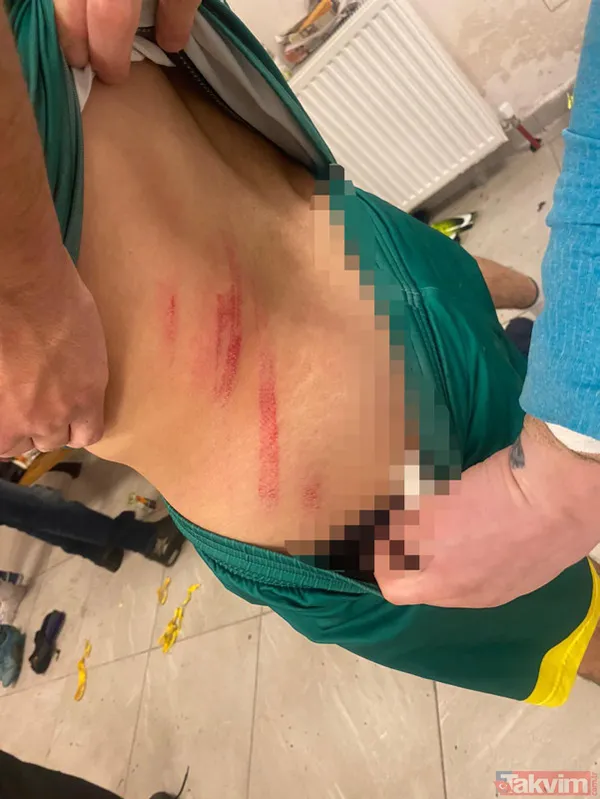 Amatör maçta taraftar sahaya daldı ortalık ringe döndü! Tekme tokat yumruk... O anlar kamerada - 16