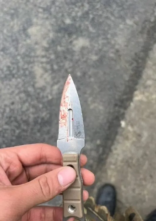 Teröristin kulağının kesildiği bıcak.