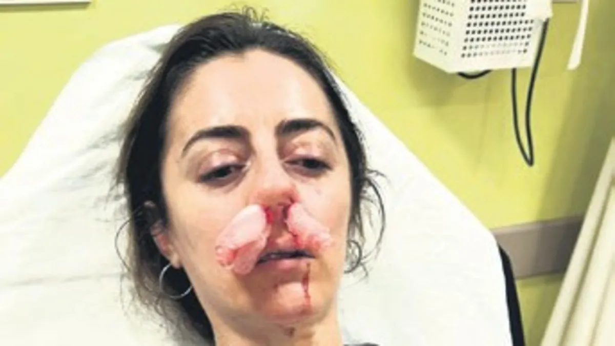 Edirne’de Hamiyet Pehlivan Bingül saldırıya uğradı: Kapı "silah" sayıldı