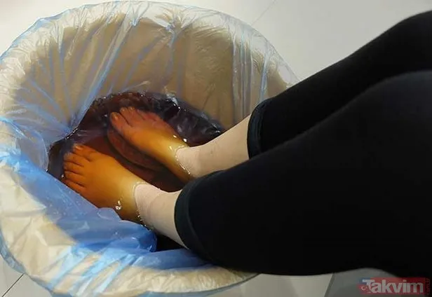 Ayak tırnak mantarına doğal tedaviler