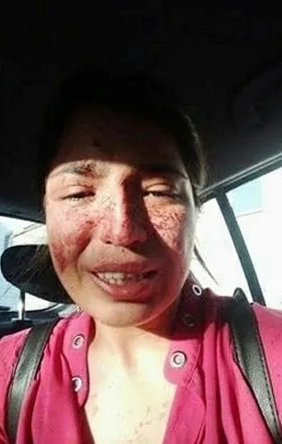 Eski eşinin saldırısına uğrayan kadından yardım çığlığı: Bu cani beni öldürmeden onu durdurun