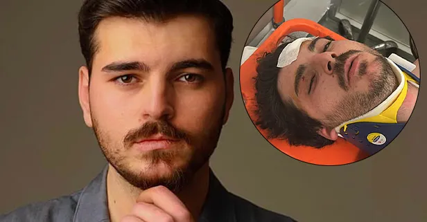 Korkunç olay! Oyuncu Mehmet Akif Akdeniz trafikte 4 kişi tarafından darp edildi: Öldürene kadar döveceklerdi!