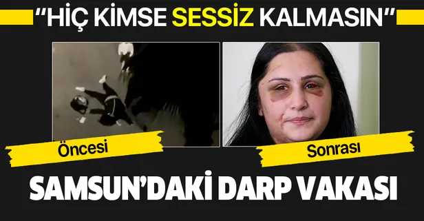 Samsun'da eski eşi İbrahim Zarap tarafından dövülen talihsiz kadın: Hiç kimse çocuğu için şiddete maruz kalıp da sessiz kalmasın