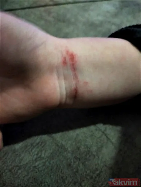 Antalya'da bir babanın iddiaları duyanları şoke etti! Parmaklarında yanık izleri, bileklerinde morluk... - 4