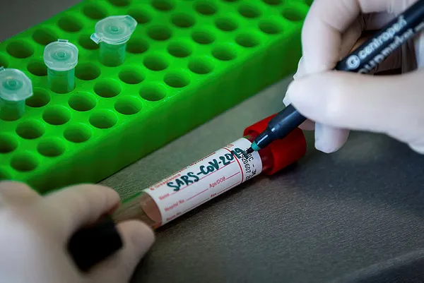 Bilim Kurulu üyesinden koronavirüs belirtileri hakkında şoke eden açıklama: Önümüzdeki haftalarda...-5