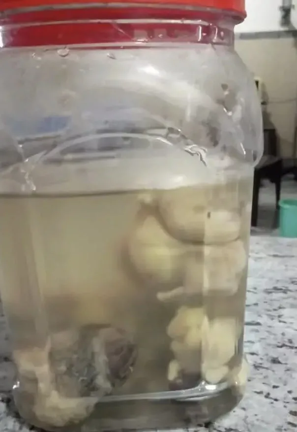 Bilim insanları dahi şaşkın! Yenidoğan bebeğin karnındaki şişliğin içinden çıkanlar kan dondurdu! Tümor sandılar ama tam 8 tane...-7