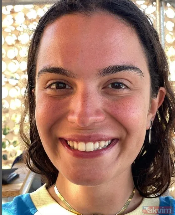 Aslı Bekiroğlu'nun suratında cam sebil patladı - 2