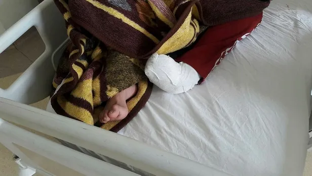 Şanlıurfa'da bulunan parmaklar kaza geçiren Hasan'ın çıktı-1