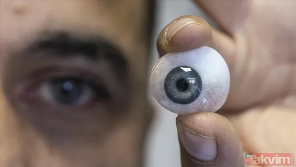 Birçok kişi fark etmiyor: Bulanık görme aslında körlüğün ilk habercisi olabilir - 2