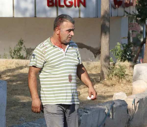 firinci-ile-borcunu-istedigi-musteriyle-yakinlarinin-odunlu-kavgasi-8-yarali-1598552188906.jpg Şanlıurfa’da fırıncı ile borçlu odunları kullanarak kavga etti: 8 yaralı-3