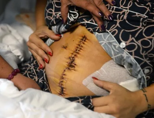 Eski sevgili dehşeti! Midesinin yüzde 30’u alındı