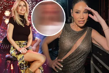 Linet’in son hali olay oldu! Dudağını gören şaştı kaldı kimse tanıyamadı Ebru Şancı Öztürk’ten bomba yorum gecikmedi: Beni yutar