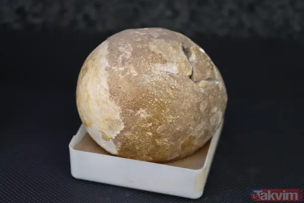 Üroloji doktorundan hayrete düşüren koleksiyon! Taşların kimisi 22 santim kimisi 650 gram - 4