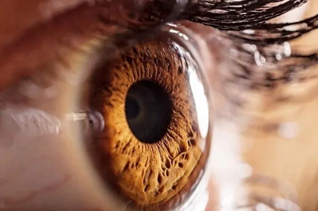 Sarı nokta hastalığı, tedavi edilmezse körlüğe neden oluyor! Sarı nokta hastalığının belirtileri nelerdir?