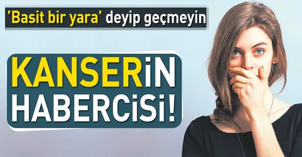 Geçmeyen AFT dil kanseri habercisi