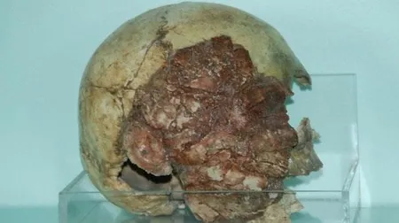 Niğde Müzesi'ndeki tarihi kafatası ilgi odağı oldu-1