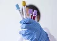 Uzman isim açıkladı! Kimler koronavirüsü belirtisiz geçirir? Koronavirüs belirtileri nelerdir?