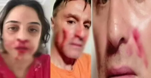 Hazım Körmükçü ile Zeynep Tandoğan barıştı (Hazım Körmükçü kimdir?)