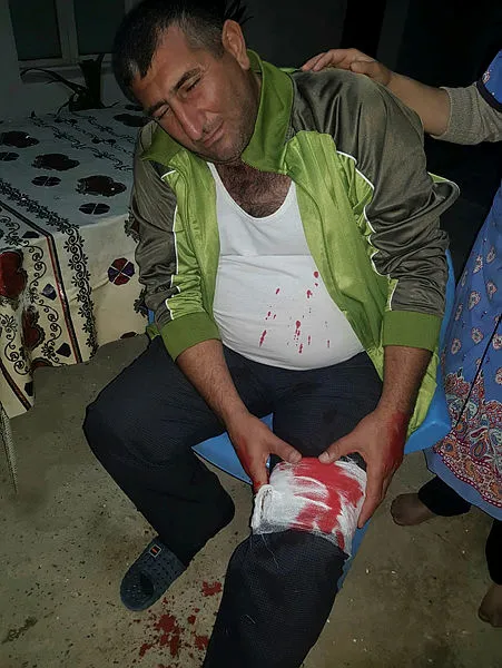 ermenistan-azerbaycan-halkini-bombaladi-iste-yarali-kardeslerimiz-1601218345069.jpg Ermenistan Azerbaycan halkını bombaladı! İşte yaralı kardeşlerimiz...-3