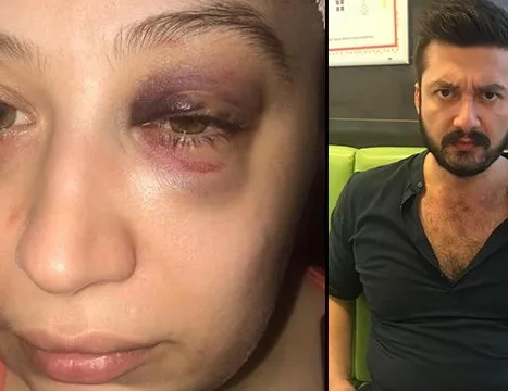 1 aydır evden çıkamıyorum